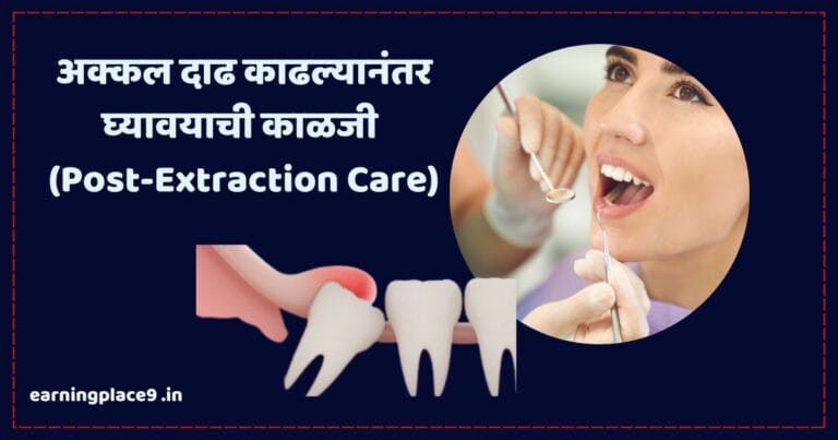 अक्कल दाढ