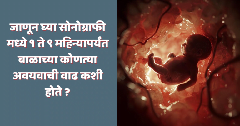 सोनोग्राफी